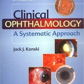 Clinical Ophthalmology: A Systematic Approach