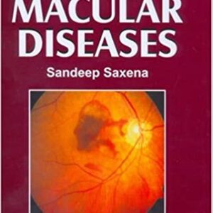 Focus on Macular Diseases