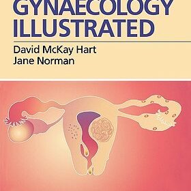 Gynaecology Illustrated, 5e [HARDCOVER] [2000] [By David McKay Hart MD FRCS(Glas) FRCOG]