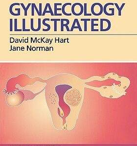 Gynaecology Illustrated, 5e [HARDCOVER] [2000] [By David McKay Hart MD FRCS(Glas) FRCOG]