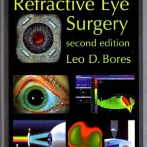 Refractive Eye Surgery