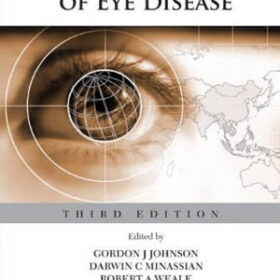 The Epidemiology of Eye Disease