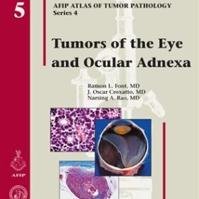 Tumors of the Eye and Ocular Adnexa (Afip Atlas of Tumor Pathology)