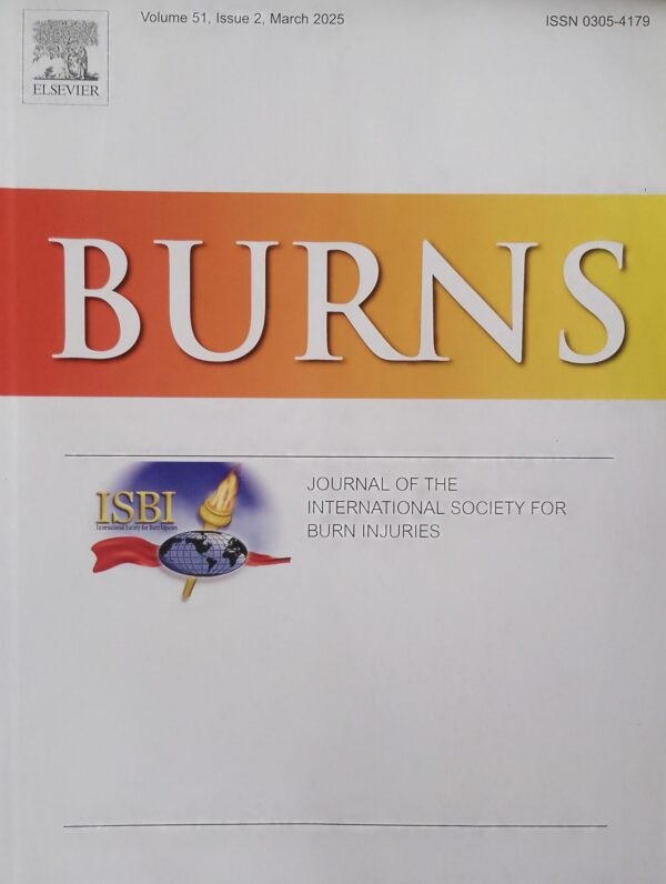 BURNS