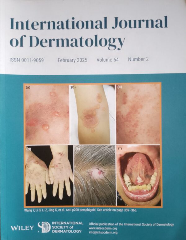 INTERNATIONAL JOURNAL OF DERMATOLOGY